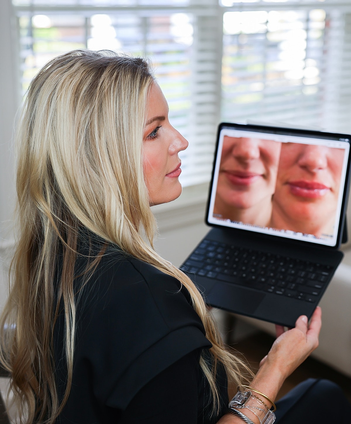 Woman examining lip enhancement photos on tablet.